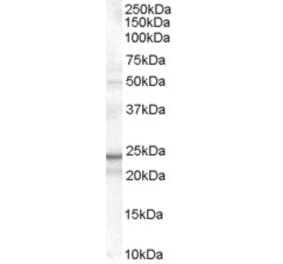 Western Blot - Anti-TIRAP Antibody (A82959) - Antibodies.com