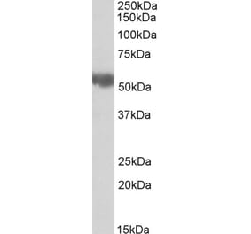 Western Blot - Anti-Aldehyde Dehydrogenase 10 Antibody (A82962) - Antibodies.com