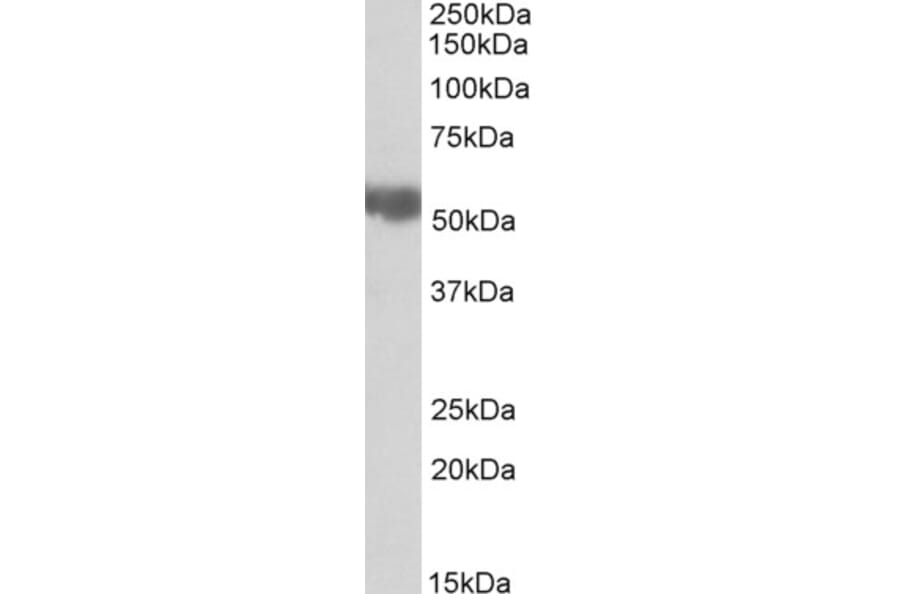 Western Blot - Anti-Aldehyde Dehydrogenase 10 Antibody (A82962) - Antibodies.com