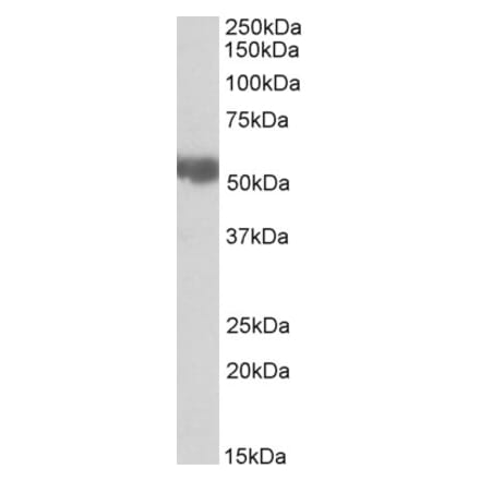 Western Blot - Anti-Aldehyde Dehydrogenase 10 Antibody (A82962) - Antibodies.com