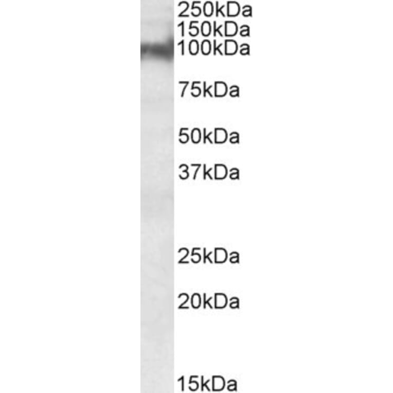 Western Blot - Anti-Plakophilin 2 Antibody (A82966) - Antibodies.com