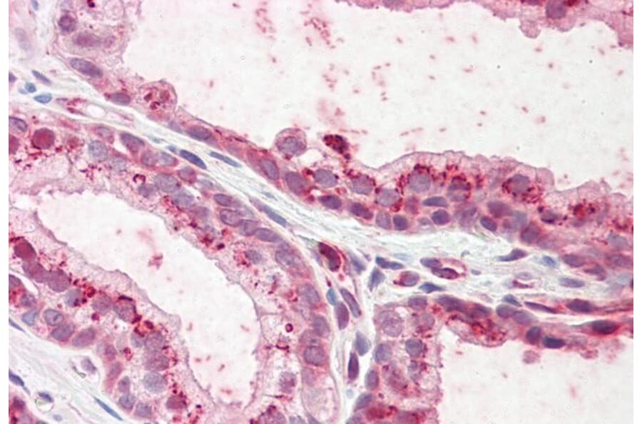 Immunohistochemistry - Anti-Plakophilin 2 Antibody (A82966) - Antibodies.com