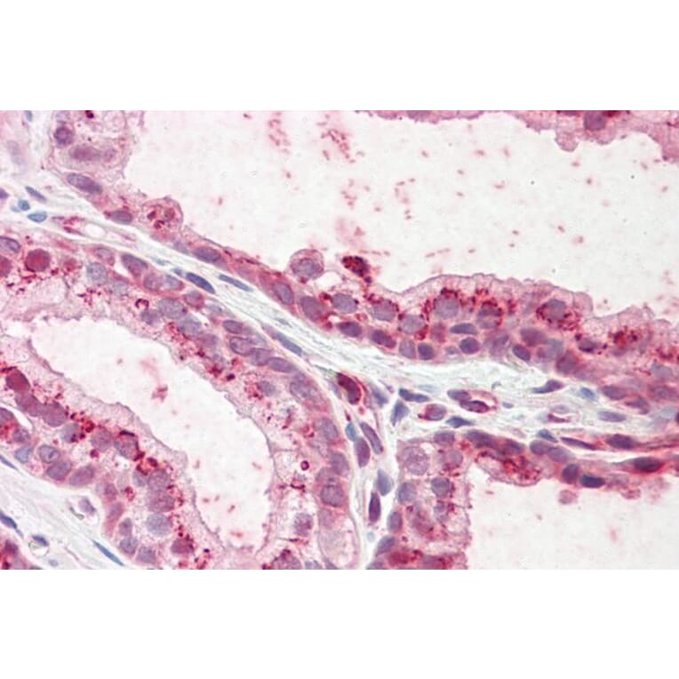 Immunohistochemistry - Anti-Plakophilin 2 Antibody (A82966) - Antibodies.com
