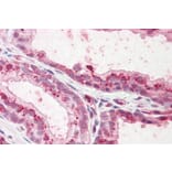 Immunohistochemistry - Anti-Plakophilin 2 Antibody (A82966) - Antibodies.com