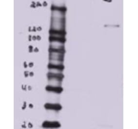 Western Blot - Anti-BTB/POZ Domain-Containing Protein 7 Antibody (A82968) - Antibodies.com