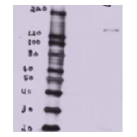 Western Blot - Anti-BTB/POZ Domain-Containing Protein 7 Antibody (A82968) - Antibodies.com