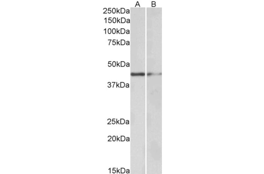 Western Blot - Anti-GATA3 Antibody (A82969) - Antibodies.com