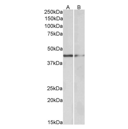 Western Blot - Anti-GATA3 Antibody (A82969) - Antibodies.com