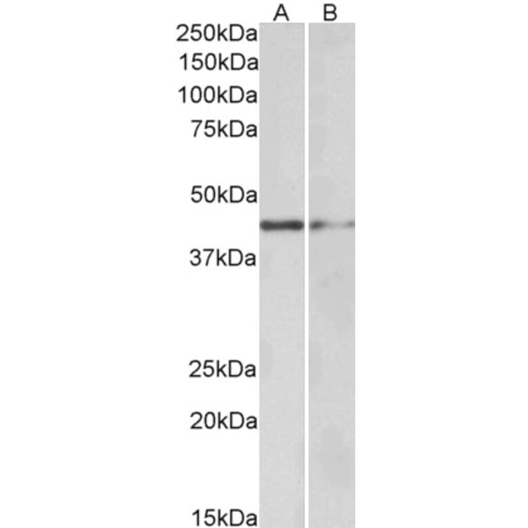 Western Blot - Anti-GATA3 Antibody (A82969) - Antibodies.com