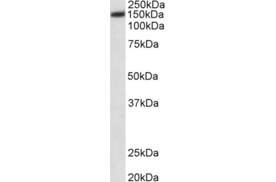 Western Blot - Anti-PMCA1 Antibody (A82970) - Antibodies.com