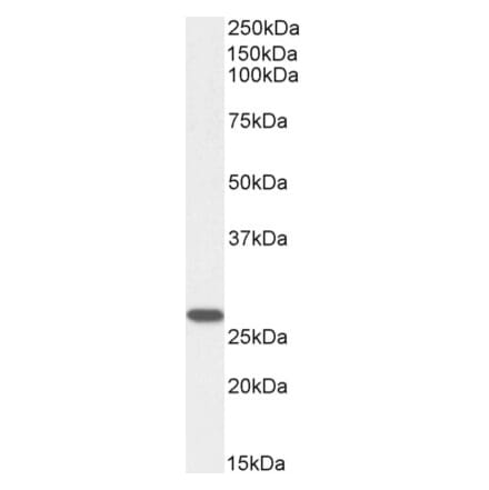 Western Blot - Anti-GSTM4 Antibody (A82971) - Antibodies.com