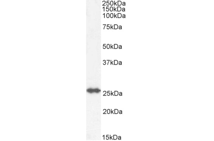Western Blot - Anti-GSTM4 Antibody (A82971) - Antibodies.com