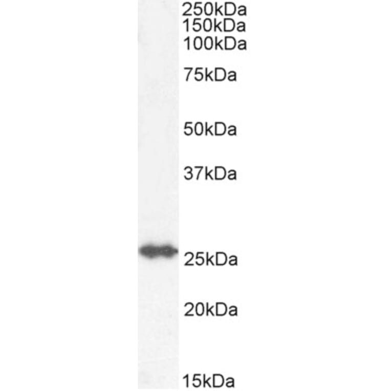 Western Blot - Anti-GSTM4 Antibody (A82971) - Antibodies.com