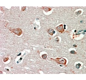 Immunohistochemistry - Anti-GABRB3 Antibody (A82974) - Antibodies.com
