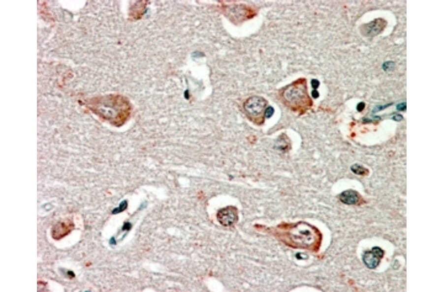 Immunohistochemistry - Anti-GABRB3 Antibody (A82974) - Antibodies.com