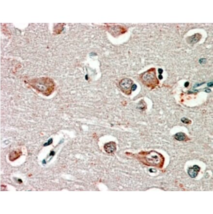 Immunohistochemistry - Anti-GABRB3 Antibody (A82974) - Antibodies.com