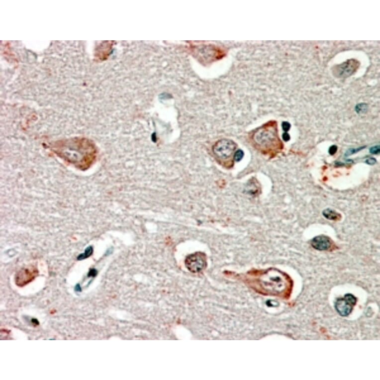 Immunohistochemistry - Anti-GABRB3 Antibody (A82974) - Antibodies.com
