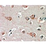Immunohistochemistry - Anti-GABRB3 Antibody (A82974) - Antibodies.com