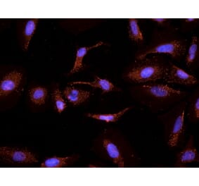 Immunocytochemistry - Anti-CYP26A1 Antibody (A82975) - Antibodies.com