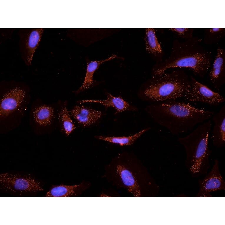 Immunocytochemistry - Anti-CYP26A1 Antibody (A82975) - Antibodies.com