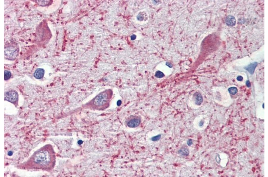 Immunohistochemistry - Anti-CYP26A1 Antibody (A82975) - Antibodies.com