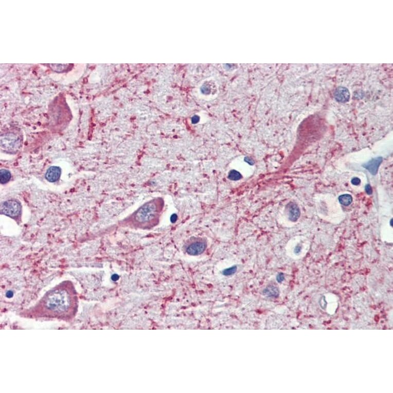 Immunohistochemistry - Anti-CYP26A1 Antibody (A82975) - Antibodies.com