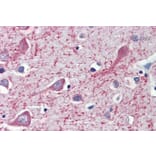 Immunohistochemistry - Anti-CYP26A1 Antibody (A82975) - Antibodies.com