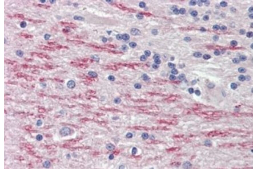 Immunohistochemistry - Anti-CYP26A1 Antibody (A82975) - Antibodies.com