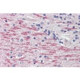 Immunohistochemistry - Anti-CYP26A1 Antibody (A82975) - Antibodies.com