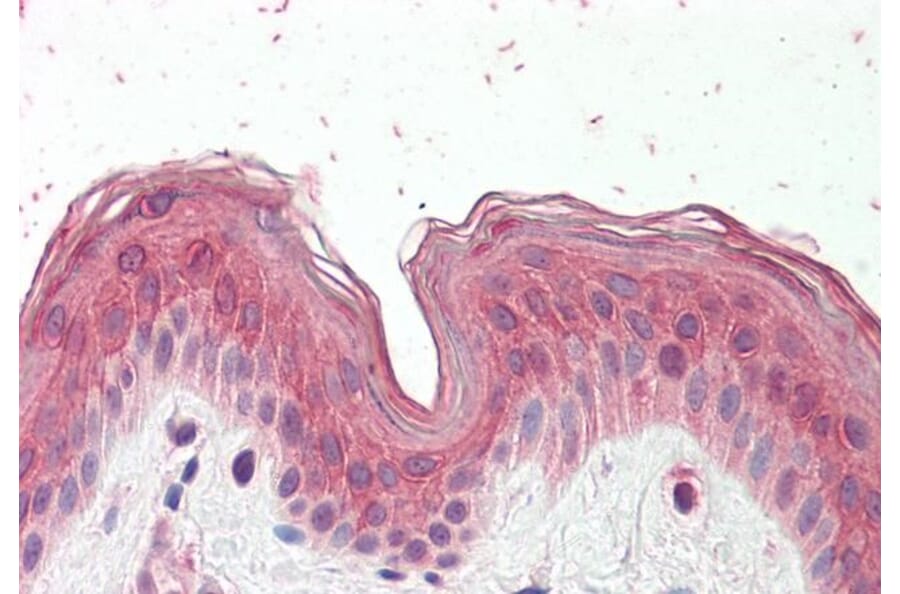Immunohistochemistry - Anti-CYP24A1 Antibody (A82976) - Antibodies.com