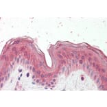 Immunohistochemistry - Anti-CYP24A1 Antibody (A82976) - Antibodies.com