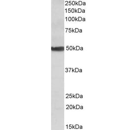 Western Blot - Anti-CYP24A1 Antibody (A82976) - Antibodies.com