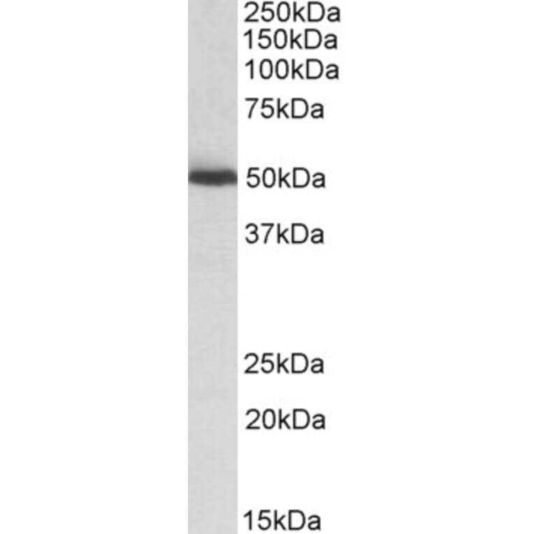 Western Blot - Anti-ALDH2 Antibody (A82977) - Antibodies.com