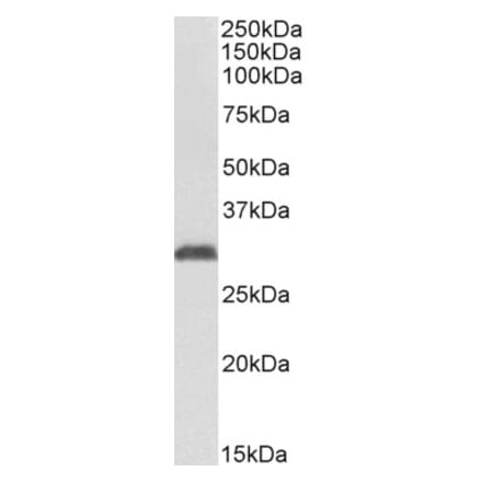 Western Blot - Anti-NAT1 Antibody (A82979) - Antibodies.com