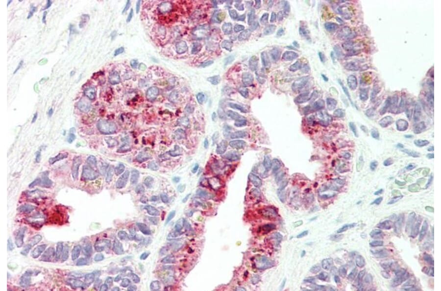 Immunohistochemistry - Anti-NAT1 Antibody (A82979) - Antibodies.com