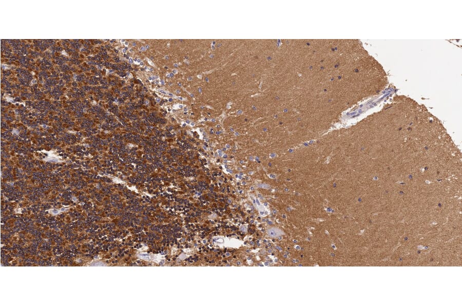 Immunohistochemistry - Anti-5HT2A Receptor Antibody (A82980) - Antibodies.com