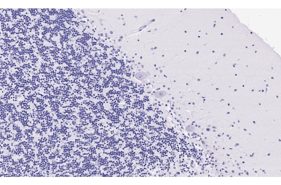 Immunohistochemistry - Anti-5HT2A Receptor Antibody (A82980) - Antibodies.com