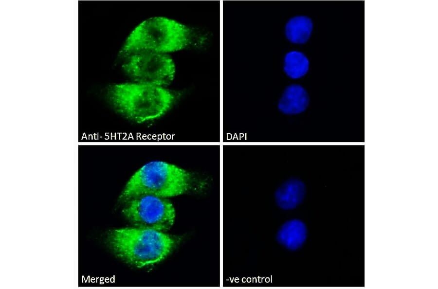 Immunofluorescence - Anti-5HT2A Receptor Antibody (A82980) - Antibodies.com