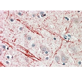 Immunohistochemistry - Anti-IGF2 Antibody (A82981) - Antibodies.com