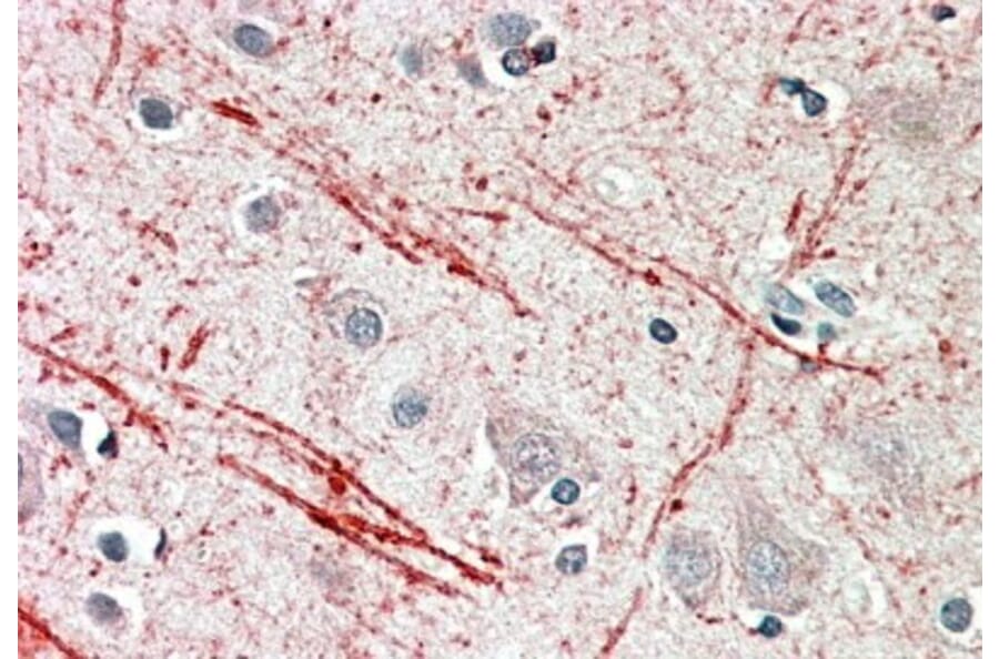 Immunohistochemistry - Anti-IGF2 Antibody (A82981) - Antibodies.com