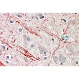 Immunohistochemistry - Anti-IGF2 Antibody (A82981) - Antibodies.com