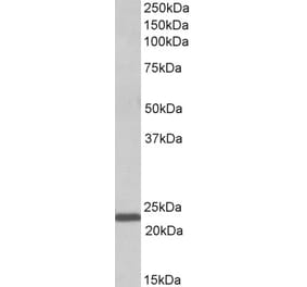 Western Blot - Anti-IL-15 Antibody (A82982) - Antibodies.com