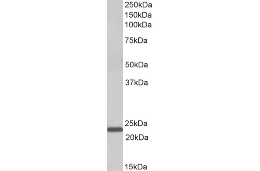 Western Blot - Anti-IL-15 Antibody (A82982) - Antibodies.com