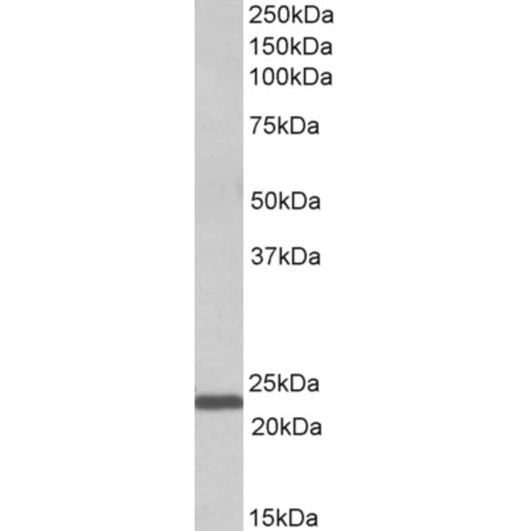 Western Blot - Anti-IL-15 Antibody (A82982) - Antibodies.com