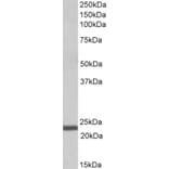 Western Blot - Anti-IL-15 Antibody (A82982) - Antibodies.com