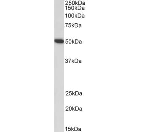 Western Blot - Anti-Fibrinogen gamma Chain Antibody (A82983) - Antibodies.com