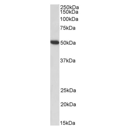 Western Blot - Anti-Fibrinogen gamma Chain Antibody (A82983) - Antibodies.com