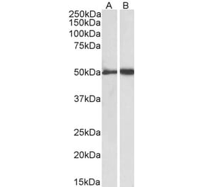 Western Blot - Anti-Fibrinogen gamma Chain Antibody (A82984) - Antibodies.com