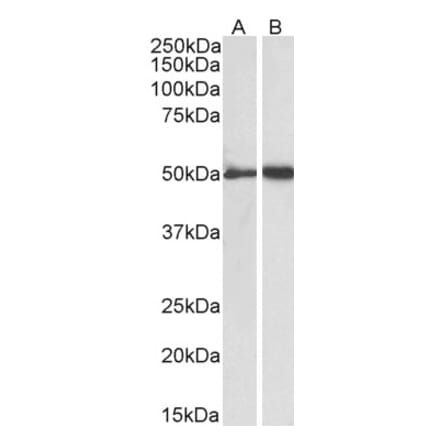 Western Blot - Anti-Fibrinogen gamma Chain Antibody (A82984) - Antibodies.com