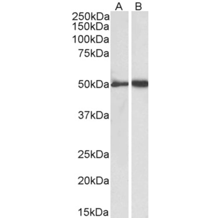 Western Blot - Anti-Fibrinogen gamma Chain Antibody (A82984) - Antibodies.com